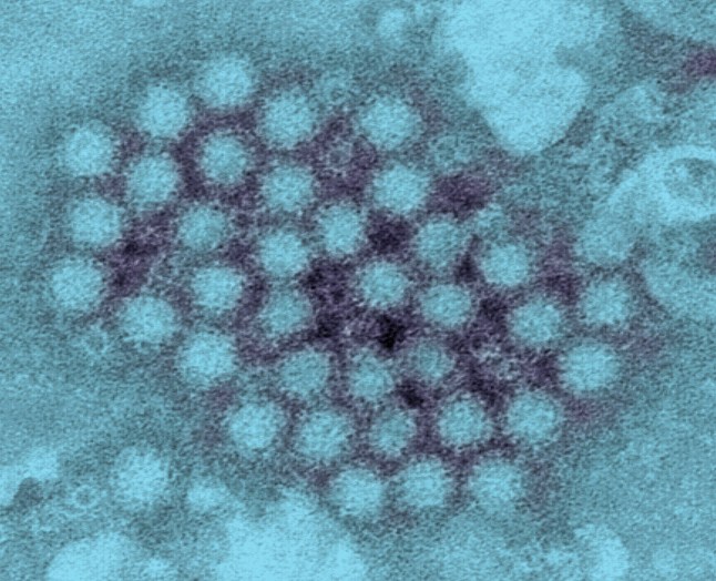 Transmission electron micrograph (TEM) of norovirus virions