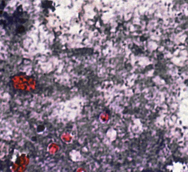 Cryptosporidium. Parasite Of The Digestive System, Provoking Intense Diarrheas. X600. (Photo By BSIP/UIG Via Getty Images)